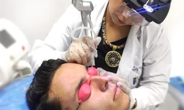 Img-Dra_Claudia_Arenas-Láser Ablativo De Co2