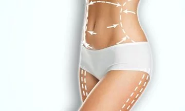 Img-Dra_Claudia_Arenas-Otros Tratamientos De Moldeo Corporal