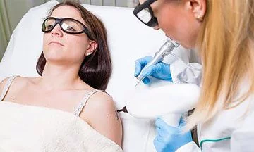 Img-Dra_Claudia_Arenas-Remoción De Tatuajes Con Láser